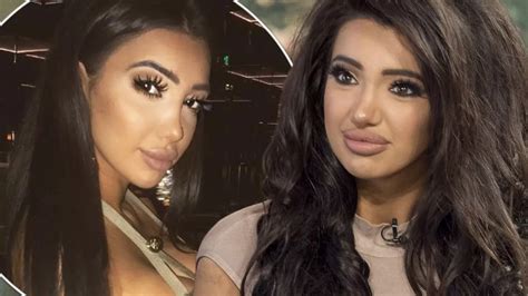 chloe khan before surgery|chloe khan ethnicity.